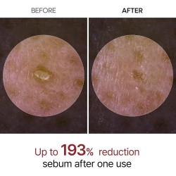 Dr.Melaxin Peel Shot Glow White Rice Peeling Ampoule 80ml – Korean Exfoliating Face & Body Scrub